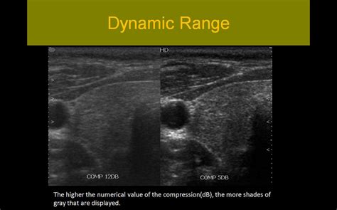 Sonographic Principles and Information Registry Review
