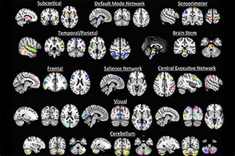 Image result for How Your Brain Pattern Matches