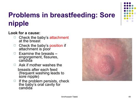 Breast feeding (benefits,phisiology,anatomy,problems,cures,cancers,bussines mom,schematic) | PPT