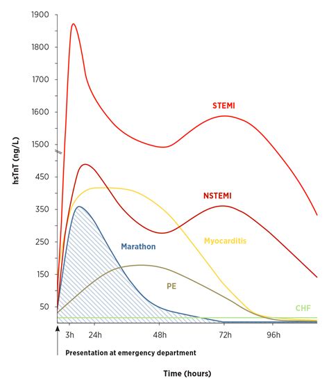 Cardiac Enzymes Troponin Levels at Bethany Knibbs blog