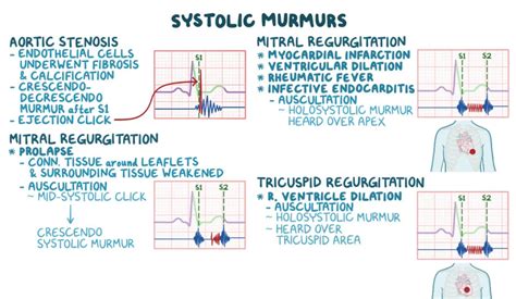 Systolic Murmurs Heart auscultations differential | PDF