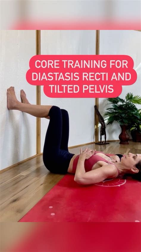 Best 13 Researching Diastasis Repair & Treatment Options – Artofit