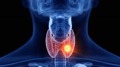 Thyroid Symptoms: শরীরে এই ৭ লক্ষণ দেখলেই সাবধান, হতে পারেন থাইরয়েড ...