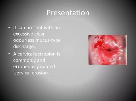 Benign diseases of the uterus and cervix | PPTX