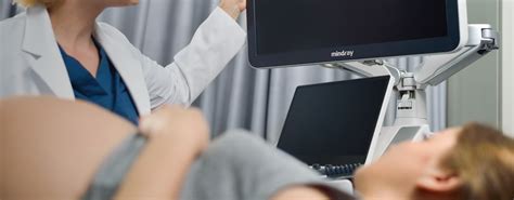 DC-80A - Diagnostic Ultrasound System - Mindray India