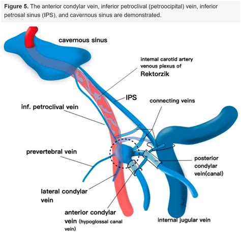 Internal Carotid Artery Cavernous Sinus