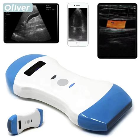 Portable Wireless Ultrasound Probe Scanner Machine Wifi Ultrasound Scanner Machine Support Ios ...