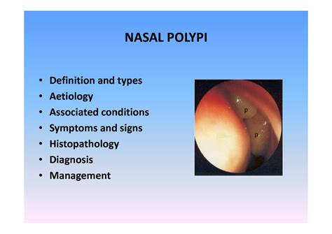 SOLUTION: Nasal polypi - Studypool