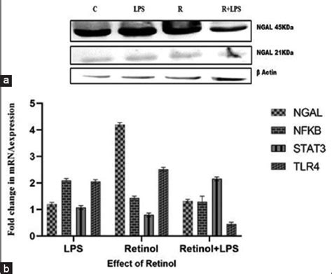 Neutrophil gelatinase-associated lipocalin a proinflammatory ...
