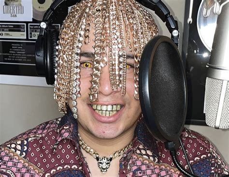 Rapper Dan Sur Gets Gold Chains Surgically Implanted Into His Scalp - A ...