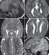 Image result for malformations