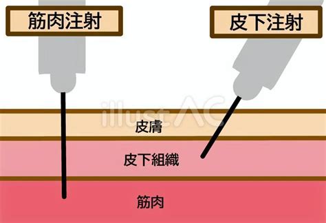 Injection Medicine 的图像结果