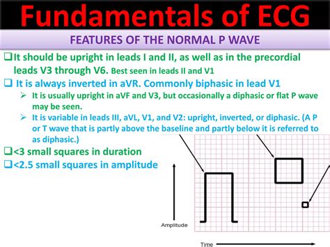 P wave abnormalities in ECG | PPSX