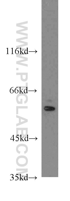 LGI1 antibody (12483-1-AP) | Proteintech