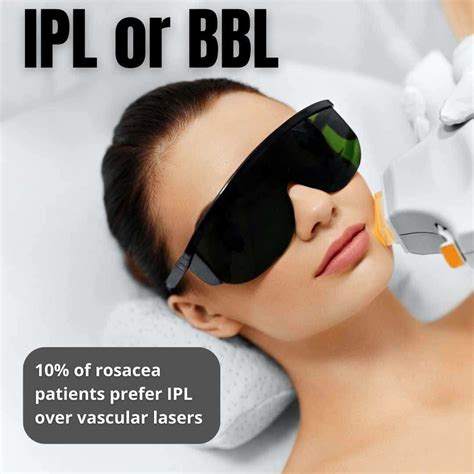 Which Laser Best For Rosacea at Logan Newbigin blog