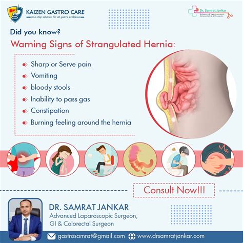 Warning signs of strangulated hernia- Dr. Samrat Jankar | Flickr