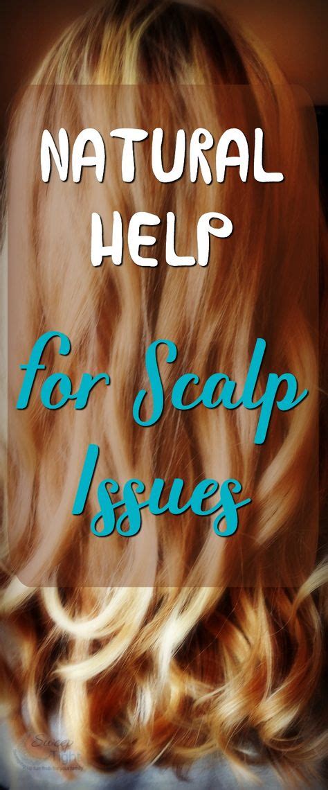 treatment for scalp psoriasis