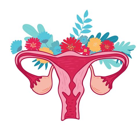 Women health - Floral of Polycystic ovary syndrome. Patient-friendly scheme of PCOS ...