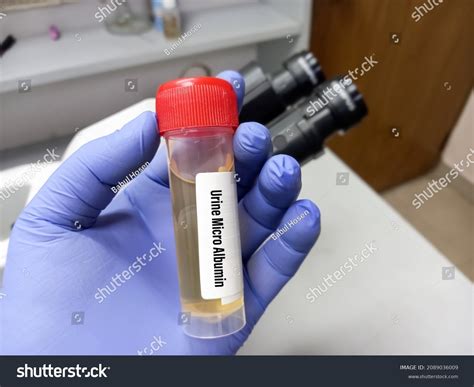 Urinalysis Microscopic Labcorp at Jennifer Desrochers blog