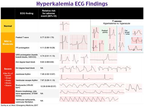Sine Wave Hyperkalemia Ecg Changes