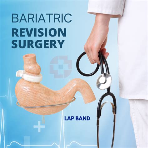 Bariatric Revision surgery