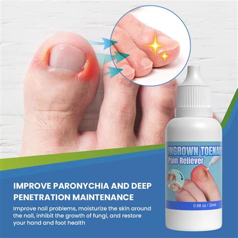Ingrown Toenail Treatment Extra Strong – Ingrown Toenail Drop- Cuticle Care Oil for Ingrown ...