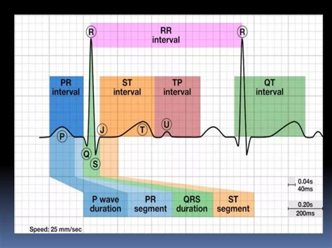 Basic ECG &rhythm interpretation | PDF