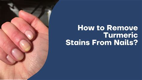 How to remove turmeric stains from nails 6 easy ways – Artofit