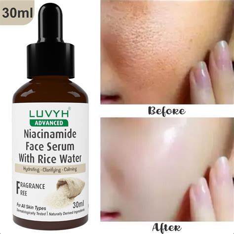 Face Serum for Men's & Women's -Luvyh Niacinamide Face Serum