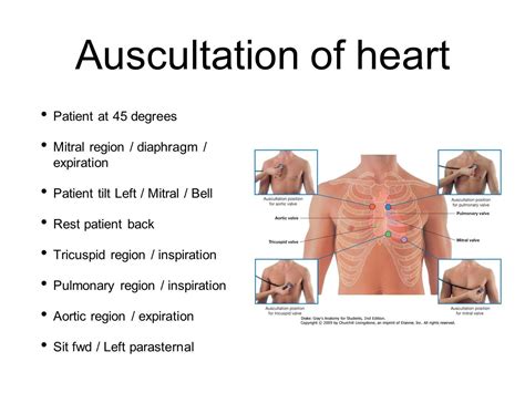 Aortic Regurgitation Murmur