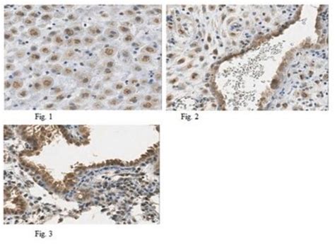Anti-Bst2 Antibody from rabbit, purified by affinity chromatography ...