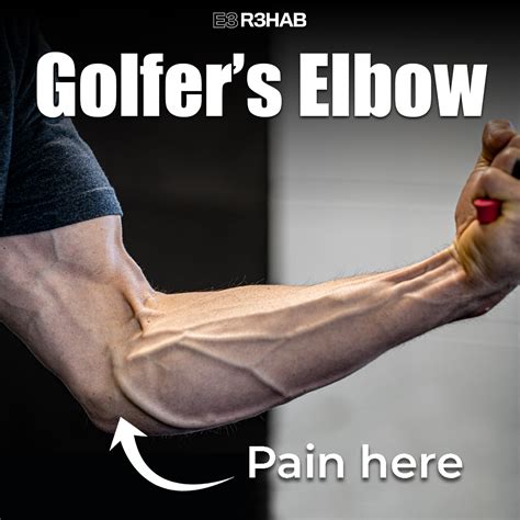 Golfer's Elbow Workout at Timothy Stump blog