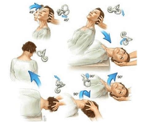 Vertigo, BPPV and the Vestibular System - Diversified Health Clinic