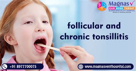 Follicular And Chronic Tonsillitis Treatment In Hyderabad - Health ...