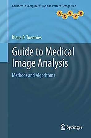 Buy Guide to Medical Image Analysis: Methods and Algorithms (Advances ...