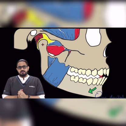 Products tagged with 'occlusion'-One Dental is the Biggest online ...