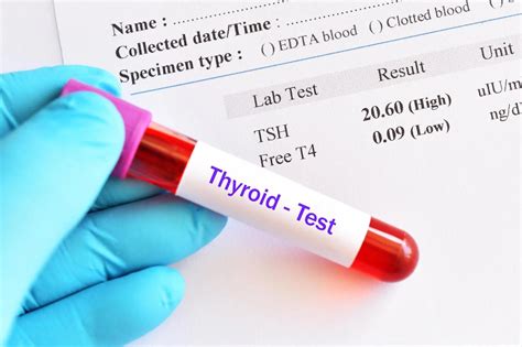 Understanding Thyroid Test Price | Health-e