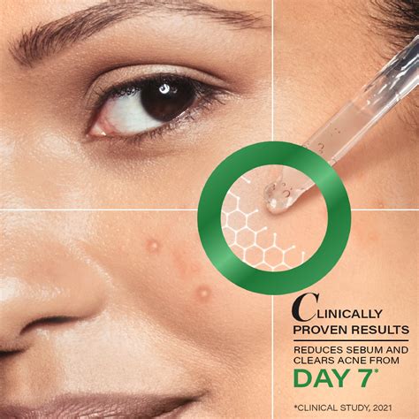 Best Serum for Acne Prone Skin with TT2 Tech | Novology