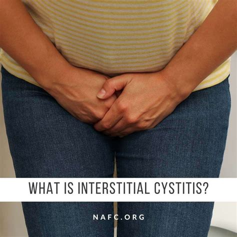 Urinary Retention - Symptoms, Causes And Treatments - NAFC