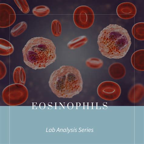 High Absolute Eosinophils