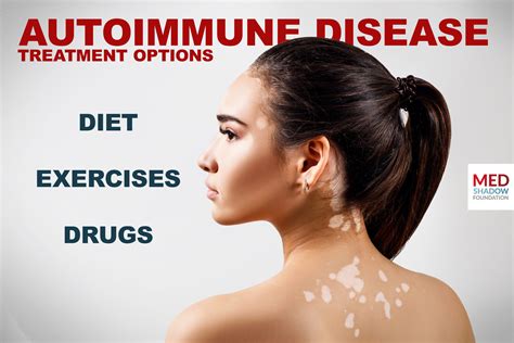 Diet, Exercise and Drugs for Autoimmune Diseases - MedShadow Foundation | Independent Health ...