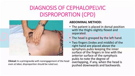 Contracted pelvis - CEPHALOPELVIC DISPROPORTION | PPTX