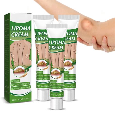 Lipomacure Soothing Ointment Lumpfree Lipoma Removal Cream Herbal Lipoma Lumps | Desertcart Sri ...