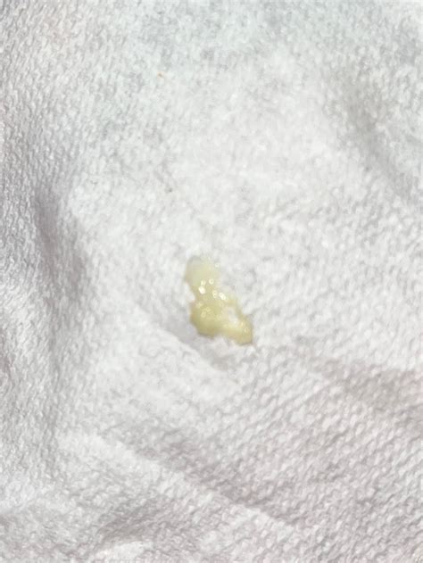 Yellowish Green Discharge