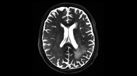 MAGNETOM Terra – 7T MRI Scanner - Siemens Healthineers India