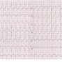 Image result for tachycardia 频脉