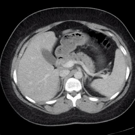 Gross Anatomy Glossary: Spleen Imaging | ditki medical & biological ...