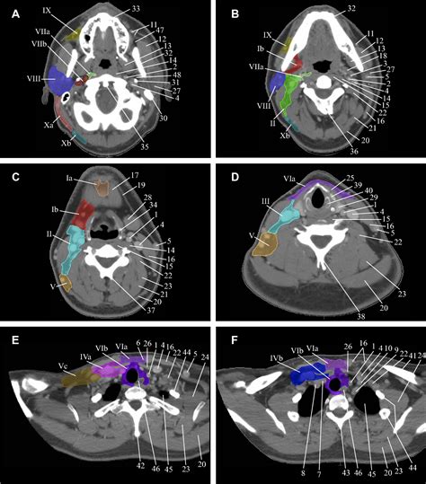 7 levels of lymph nodes in neck - ladegpico