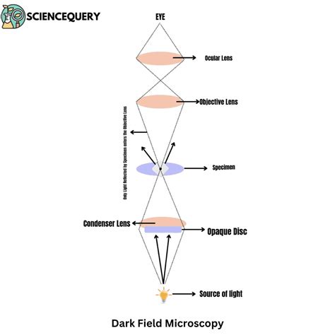 Dark Field Microscope - ScienceQuery