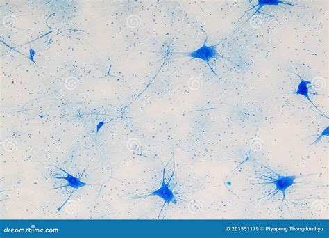 Spinal Cord and Motor Neuron Under the Microscope. Stock Image - Image of axon, microscope ...